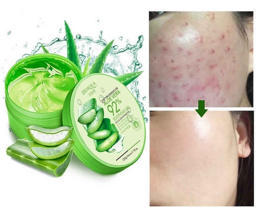 Gel Aloe Vera Quita Marcas Cicatrices Acné Original Puntos