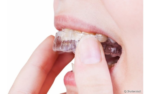 Placa Dental Descanso Bruxismo/ Contención Ortodoncia