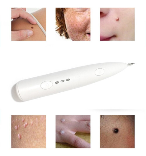 Caneta Laser Removedor Verruga Manchas Tatuagem Pintas!