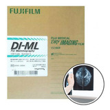 Pelicula Radiografica Laser Fuji Film Di-ml 25x30