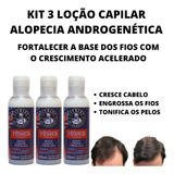 Tratamento Antiqueda Cuidado Diário Unissex Kit Com 3 Loções