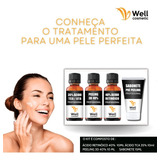  Kit Ácido Retinoico 40% + Peeling 3d 40% + Ácido Tca 35% 