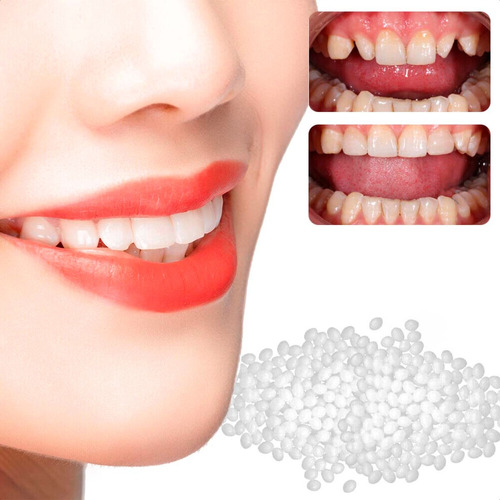 Pack X3 Dientes Postizos Provisorios Temporales Moldeables 