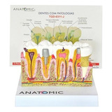 Patologia Dentária E Placa Explicativa Em 2 Partes, Anatomia