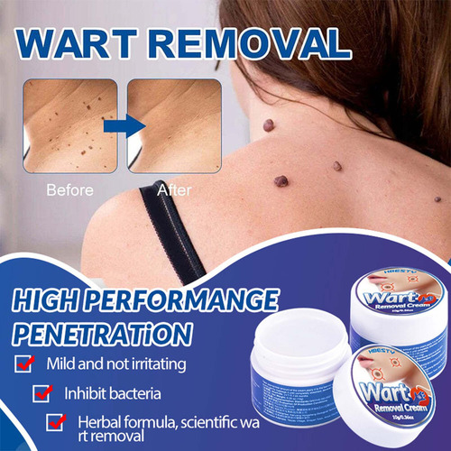 Skin Tag Remover Crema De Eliminación De Verrugas Y Lunares