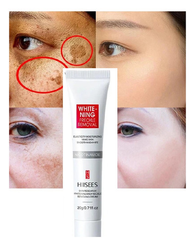 Pomada Reparadora Facial Clareadora Manchas Sardas, Melasma