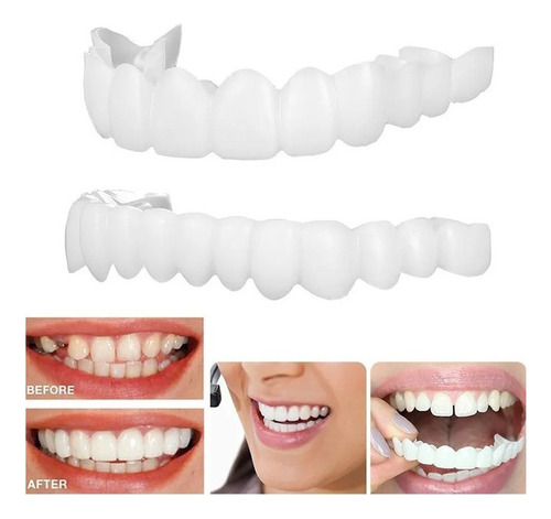 Prótesis Dentadura Postizo Snap On Smile Superior E Inferior