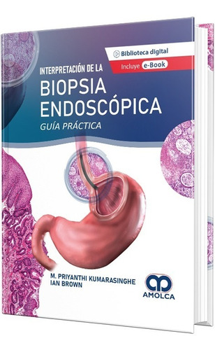 Interpretación De La Biopsia Endoscópica. Guía Práctica.