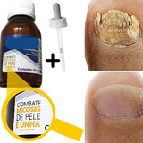  Anti Micose De Unha Melhor Que Esmalte Lakesia Oferta 50ml