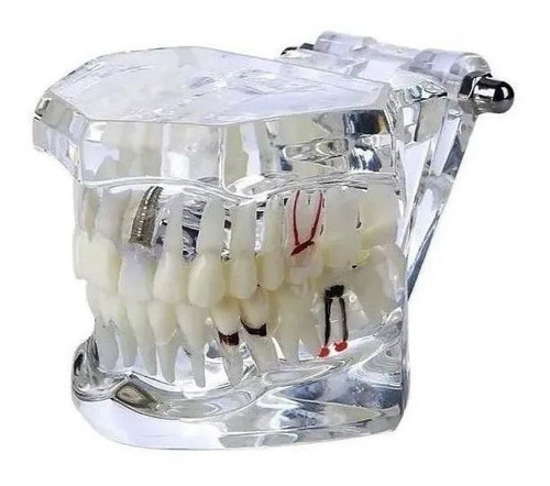 Manequim Modelo Molde Dentário Dental Boca Transparente