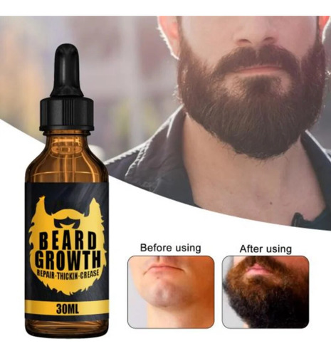 Potenciador Natural Esencial Para El Crecimiento De La Barba