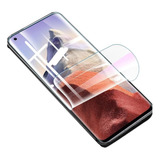 Lamina Hidrogel Xiaomi 9/ 9pro/ 10/ 10s/ Mi 11 Front + Back