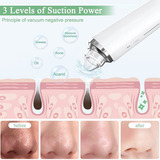 Blackhead Remover Pore Vacuum, Usa Fdawifi Visible Facial