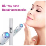 Caneta Laser Luz Azul Acne Terapia Cicatriz Portátil