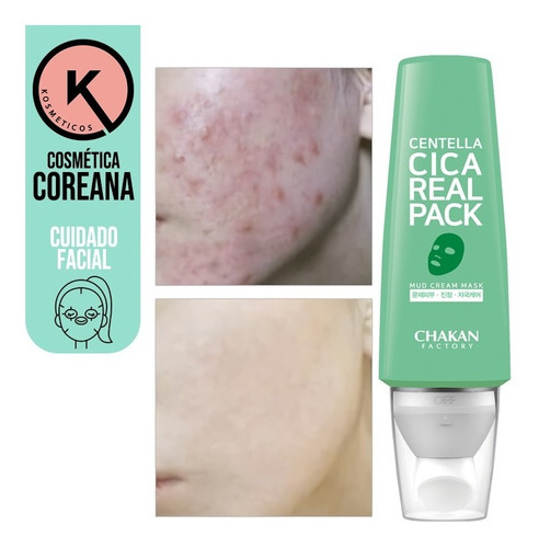 Centella Real Cica Pack Control Sebo Poro Cosmética Coreana