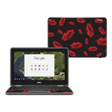 Mightyskins Skin Compatible With Dell Chromebook 11  - Kiss.