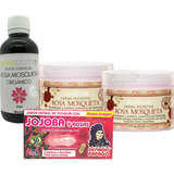 Kit Aceite Rosa Mosqueta + 2 Cremas Rosa M + Jabón De Jojoba