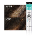 Loréal Paris Root Rescue Medium Brown 5 2pk