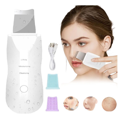 Limpiador Facial Ultrasónico Exfoliante De Belleza