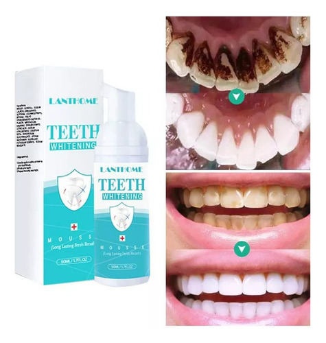 Espuma Blanqueadora De Dientes De 3 Pie - mL a $734