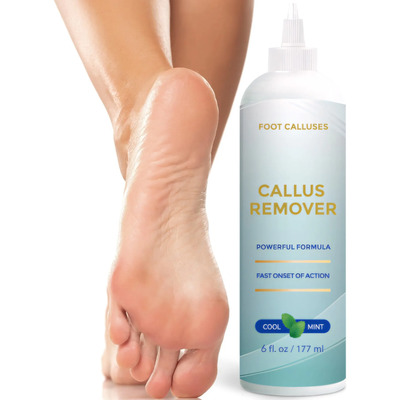 Gel Para Callos En Pies 177ml Suaviza Piel Muerta