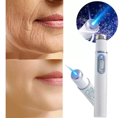 Equipo Tratamiento Laser Uv Facial Anti Acne Arrugas Tensor 