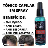 Loção Spray Anti Caspa E Queda Fortalece O Bulbo Capilar Top