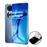 Protector De Pantalla Para Huawei Hidrogel Brillante Hd