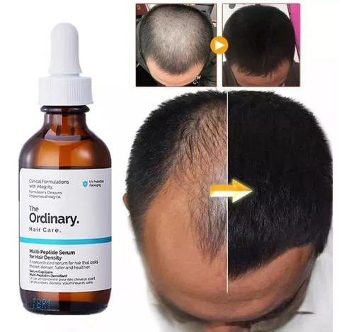 The Ordinary Multi-peptide Serum For Hair Density, 60 Ml Momento De Aplicación Día/noche Tipo De Piel Todo Tipo De Piel