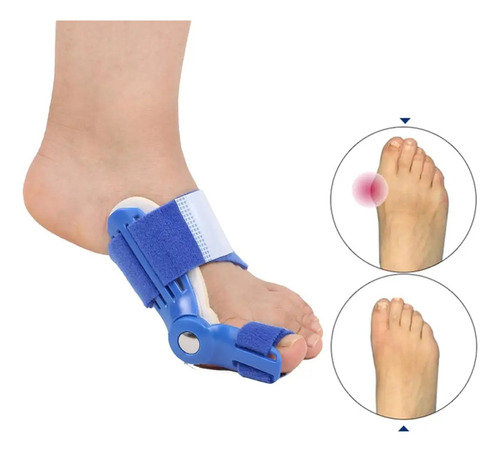 Aparato Ortopédico Hallux Valgus Para Juanetes Toe Correc, 1