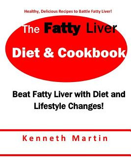 Libro The Fatty Liver Diet & Cookbook: Beat Fatty Liver W...