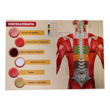 Mapa De Ventosoterapia