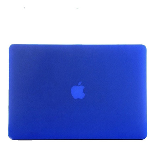 Carcasa Azul Para Macbook Pro Retina 15 / A1398