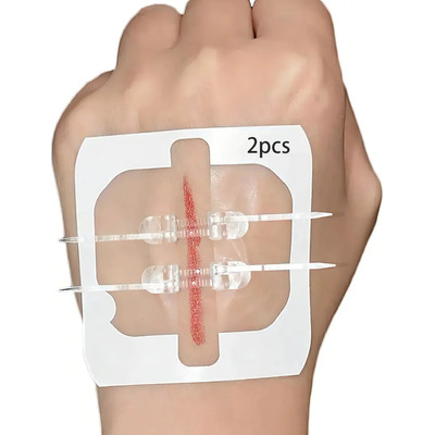 Tiras de Cierre de Heridas de Emergencia Marca Jzuczv 2 unidades | MercadoLibre