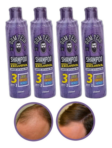 Dom Pelo Shampoo Nixidil Kit  Com 4 Unidades 250 Ml Cada