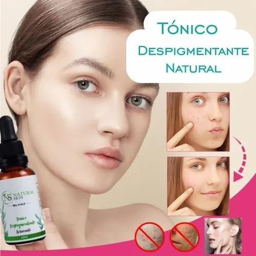 Tonico Quita Acne  Natural Skin - L a $667