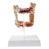 Modelo De Estudio De Patología Del Intestino Grueso Humano 1