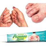 1 Creme Pomada Psoriase Eczema Dermatite Coceira