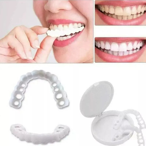 Dentadura Snap On Smile Superior E Inferior 