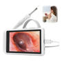 Otoscopio Digital 3,9 Mm Hd Oído Alcance Endoscopio Otoscopio Digital 3,9 Mm Hd Oído Alcance Endoscopio