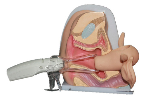 Modelo Vagina Reprodutiva Feminina Ginecológico Ovario