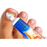 Creme Para Fungos E Micoses Das Unhas Dos Pés E Das Mãos 