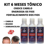 Kit 3 Loção Alopecia Areata Nasce Cresce E Fortalece Unissex