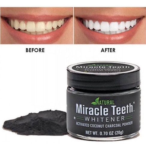 Crema Pasta Dental Blanqueadora Carbon Miracle Teeth 20grs