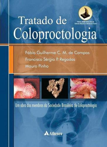 Tratado De Coloproctologia, De Campos, Fábio Guilherme C. M. De. Editora Atheneu Ltda, Capa Mole Em Português, 2012