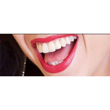 Dentes Postiço De Resina+massa Fixar. Avulso. A2. Provisór