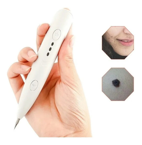 Cauterizador Digital Elimina Verrugas Manchas Tatuajes Acne