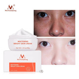 La Crema Blanqueadora Para Pecas Meiyanqiong Elimina Las Man