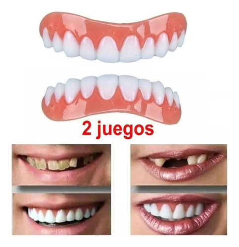 2 Juegos De Dentaduras Postizas De Silicona Simuladas Blanqu