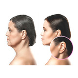 Bandas De Estiramiento Facial